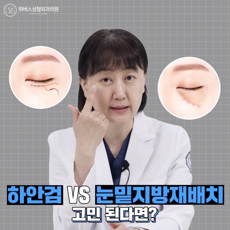 하안검 vs 눈밑지방재배치, 중년 눈 성형 (2편) 하나만 선택한다면?