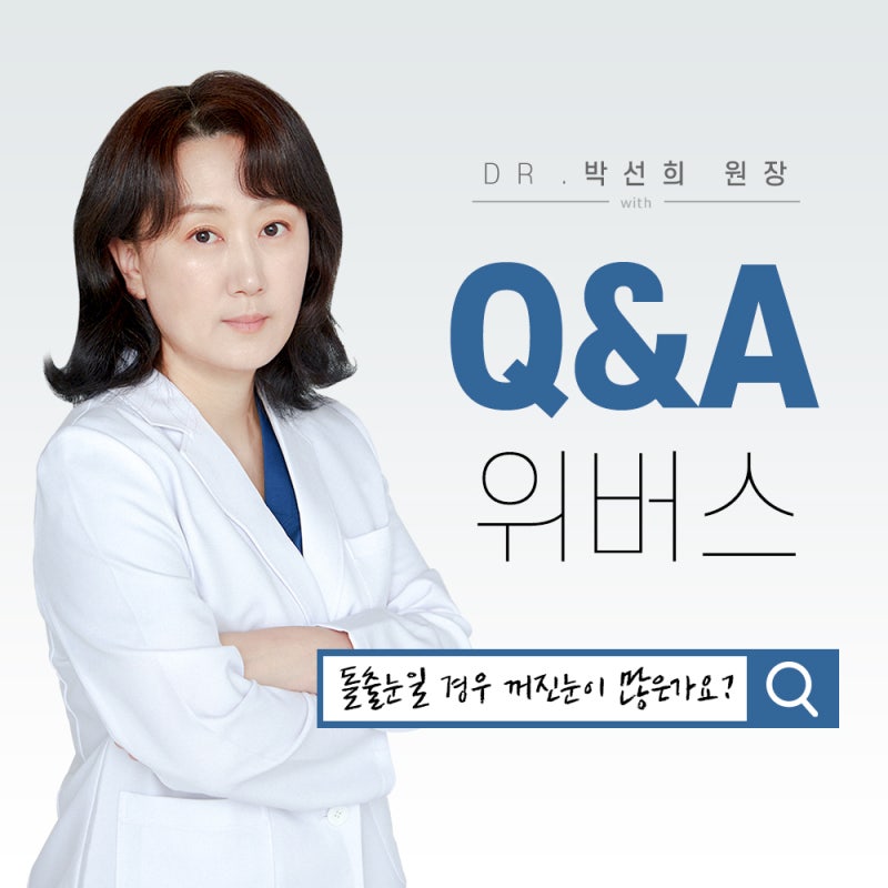 돌출 눈일 경우 꺼진 눈이 많은가요?