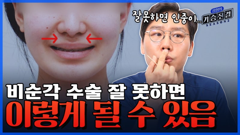 처진 코 비순각코성형 과연 해도 될까?