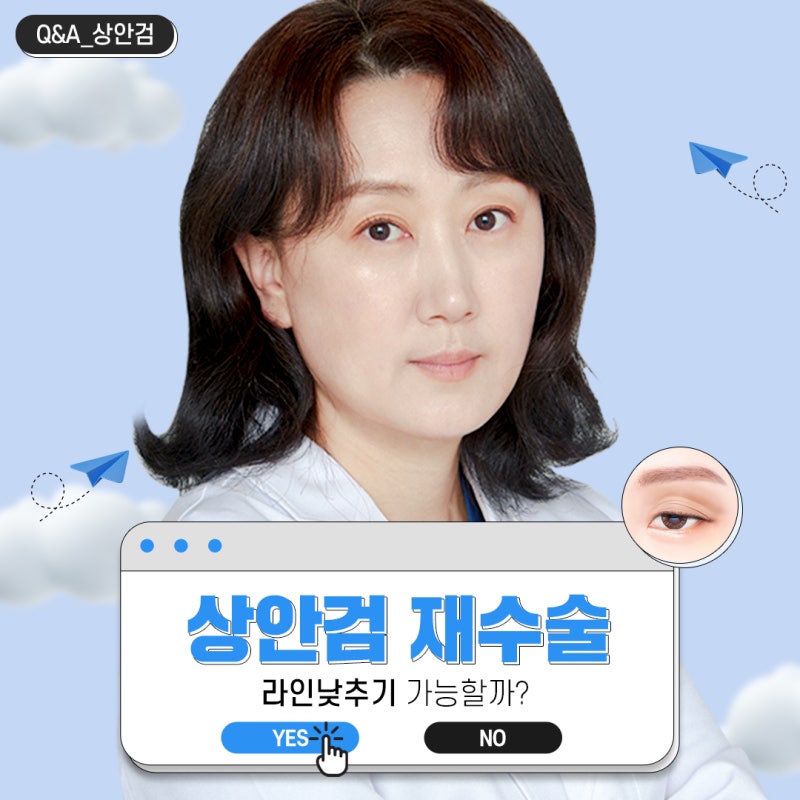 상안검 재수술, 라인 낮추는 것이 가능한가요?