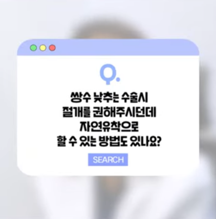 降低雙眼皮線條只能透過切開法嗎？