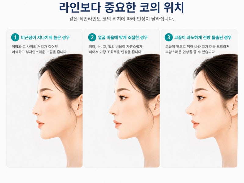제 얼굴에도 직반라인 코가 어울릴까요? 얼굴형보다 중요한 조건 사진 4